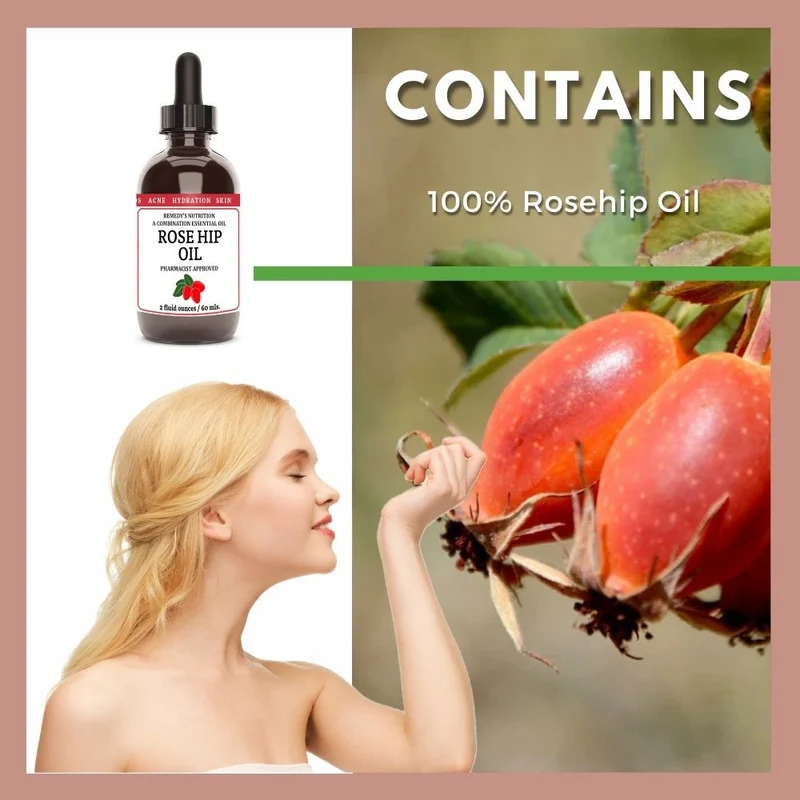 Huile de rose musquée 2 oz